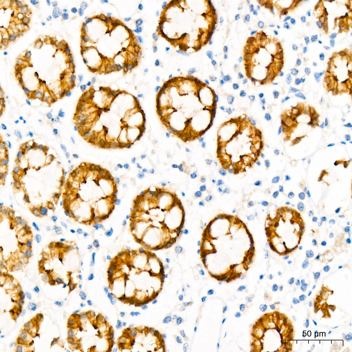 Villin1 Mouse mAb