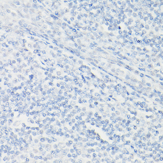 Villin1 Mouse mAb