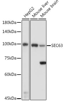 SEC63 Rabbit pAb