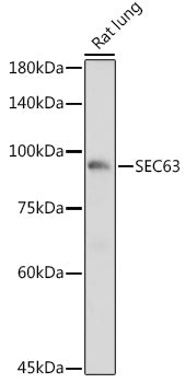 SEC63 Rabbit pAb