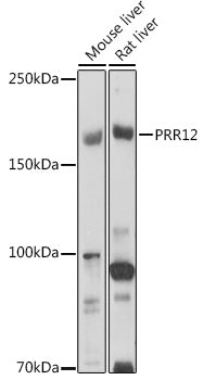PRR12 Rabbit pAb