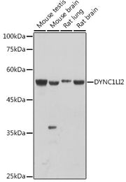 DYNC1LI2 Rabbit pAb