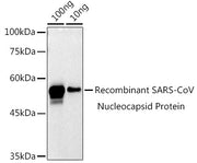 SARS-CoV-2 N Protein Rabbit pAb