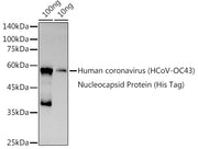 HCoV-OC43 Nucleoprotein Rabbit pAb