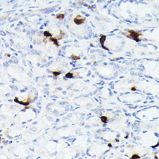 Somatostatin (SST) Rabbit mAb