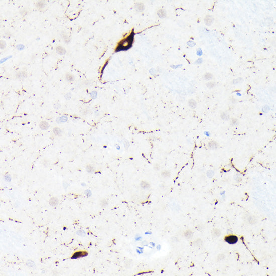 Somatostatin (SST) Rabbit mAb