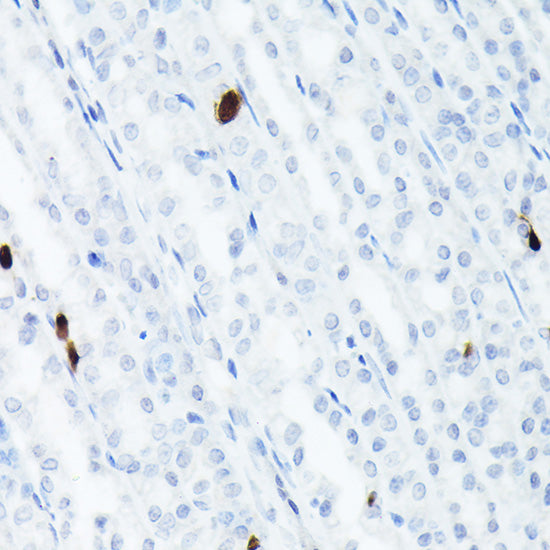 Somatostatin (SST) Rabbit mAb