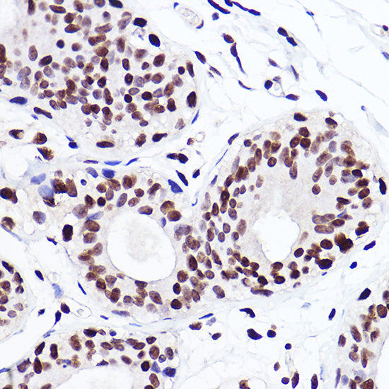 MonoMethyl-Histone H3-K18 Rabbit mAb