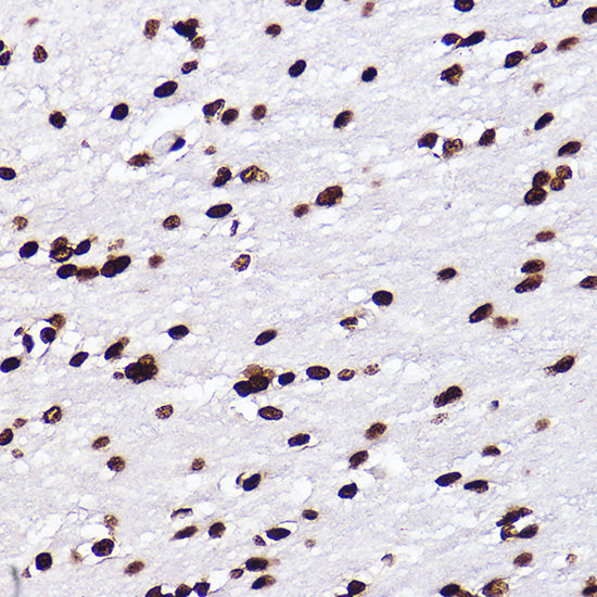 MonoMethyl-Histone H3-K18 Rabbit mAb