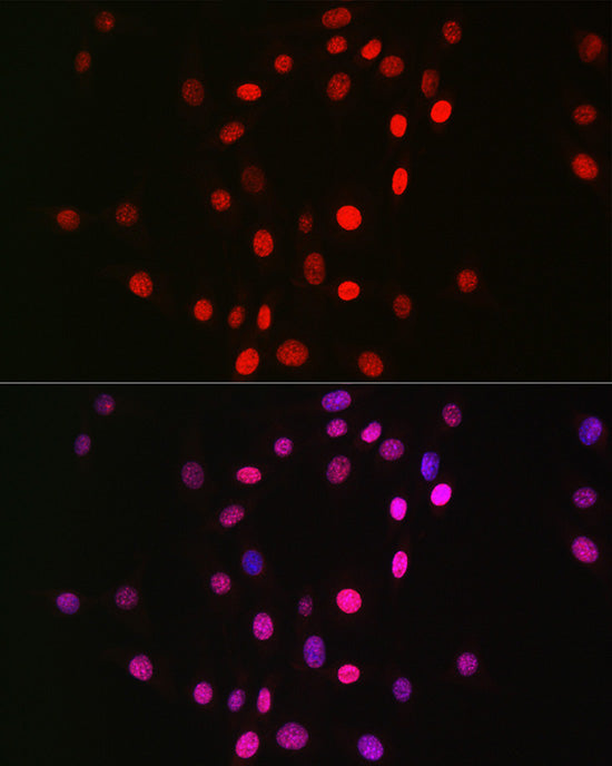 MonoMethyl-Histone H3-K18 Rabbit mAb