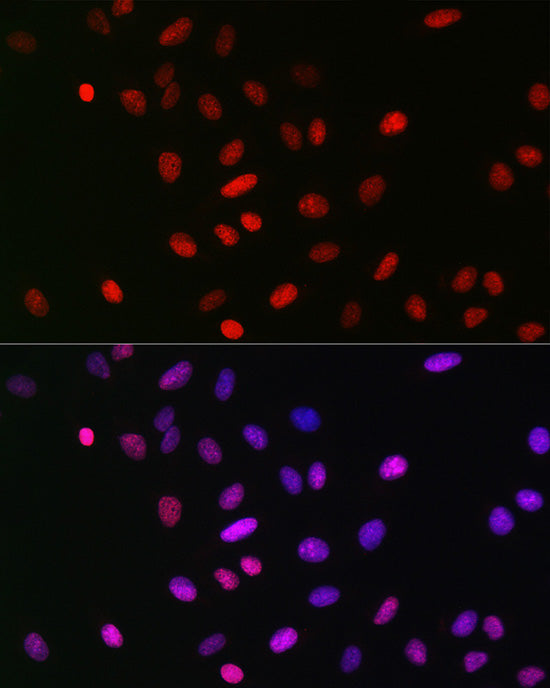 MonoMethyl-Histone H3-K18 Rabbit mAb