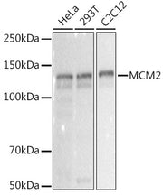 MCM2 Rabbit mAb