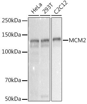 MCM2 Rabbit mAb