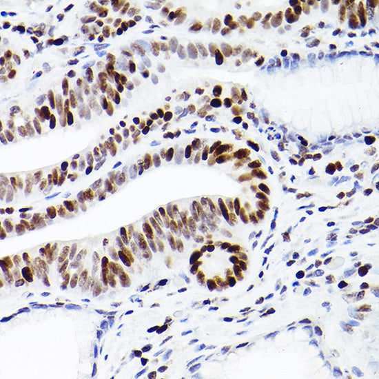 MCM2 Rabbit mAb