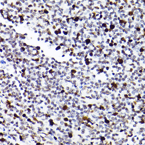 MCM2 Rabbit mAb