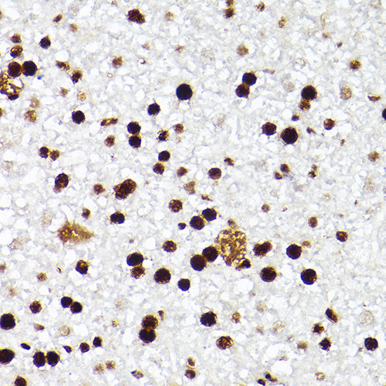 MCM2 Rabbit mAb