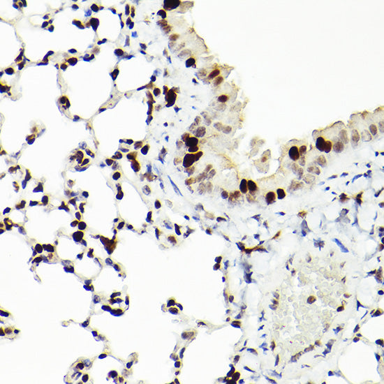 MCM2 Rabbit mAb