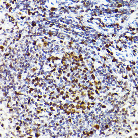 MCM2 Rabbit mAb