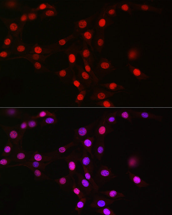 MCM2 Rabbit mAb