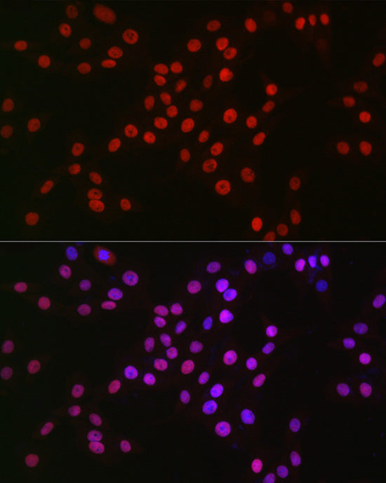 MCM2 Rabbit mAb