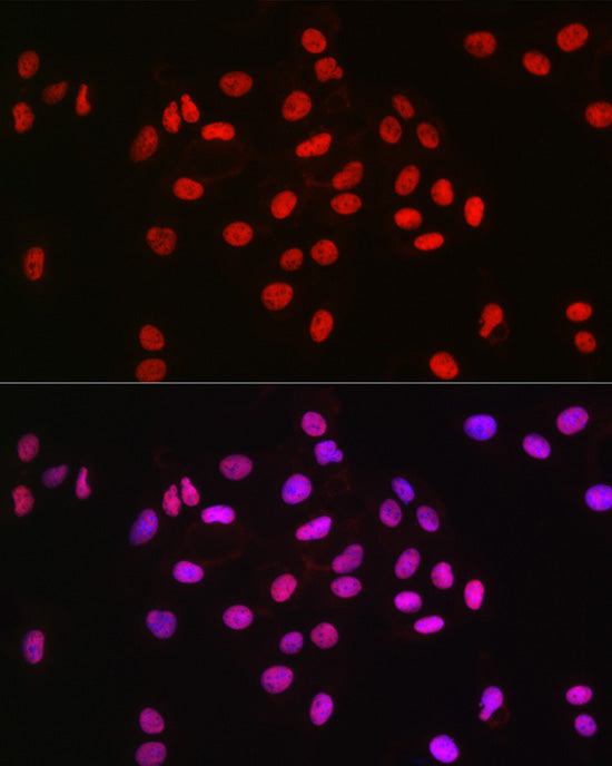MCM2 Rabbit mAb