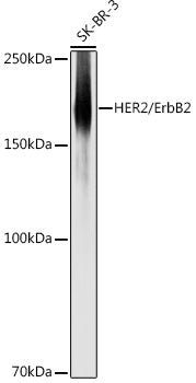 HER2/ErbB2 Rabbit pAb