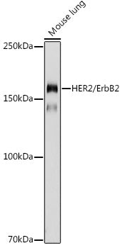HER2/ErbB2 Rabbit pAb