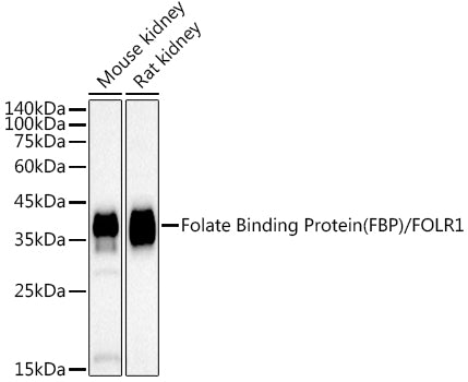 Folate Binding Protein(FBP) / FOLR1 Rabbit mAb