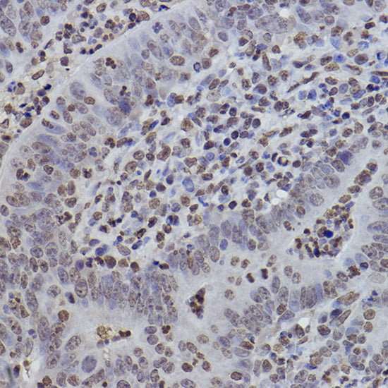 MonoMethyl-Histone H3-K9 Rabbit mAb