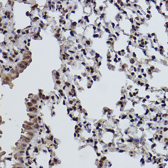 MonoMethyl-Histone H3-K9 Rabbit mAb