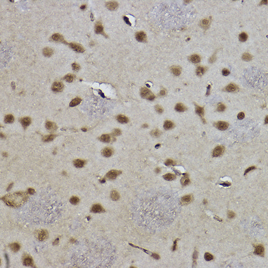 MonoMethyl-Histone H3-K9 Rabbit mAb