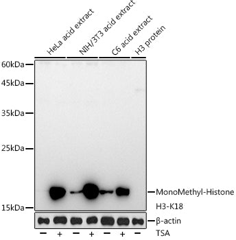 Acetyl-Histone H3-K18 Rabbit mAb