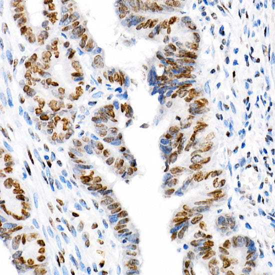 Acetyl-Histone H3-K18 Rabbit mAb