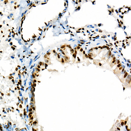 Acetyl-Histone H3-K18 Rabbit mAb
