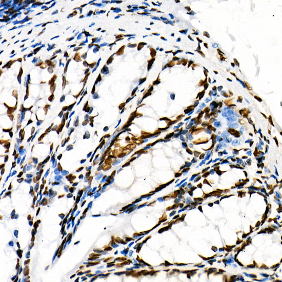 Acetyl-Histone H3-K18 Rabbit mAb