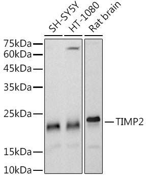 TIMP2 Rabbit mAb