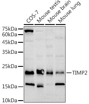 TIMP2 Rabbit mAb