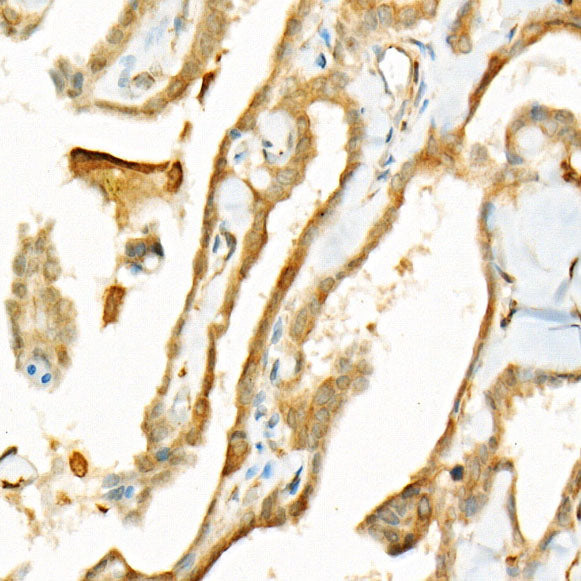 Bcl-2 Mouse mAb