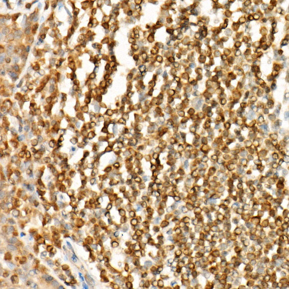 Bcl-2 Mouse mAb