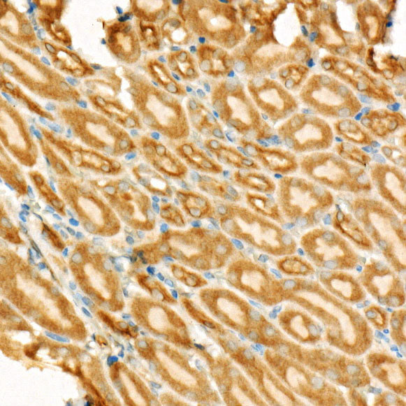 Bcl-2 Mouse mAb
