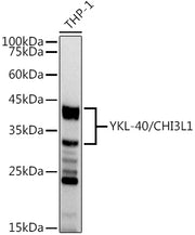 YKL-40/CHI3L1 Rabbit mAb
