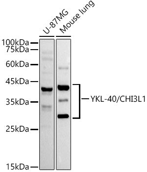 YKL-40/CHI3L1 Rabbit mAb