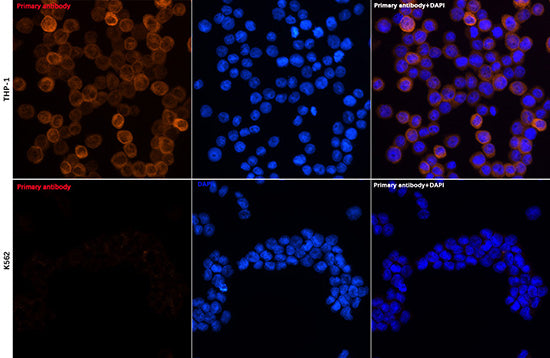 YKL-40/CHI3L1 Rabbit mAb