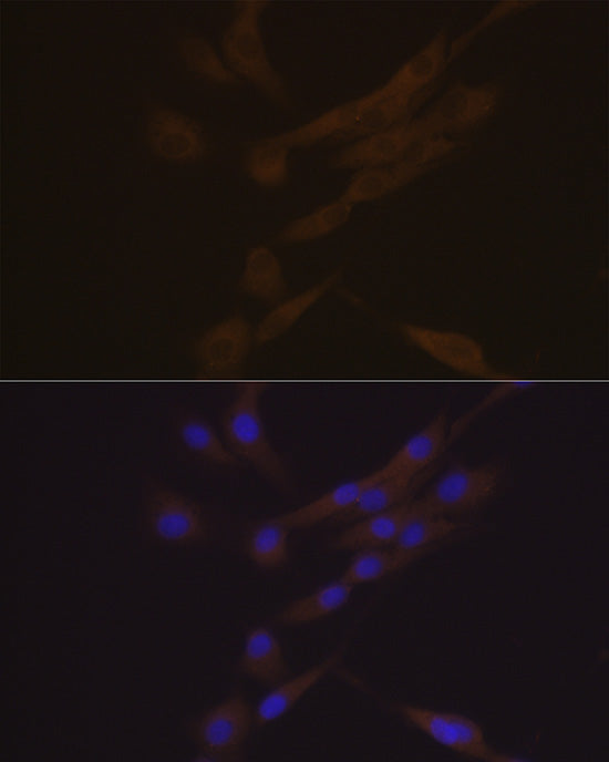 YKL-40/CHI3L1 Rabbit mAb