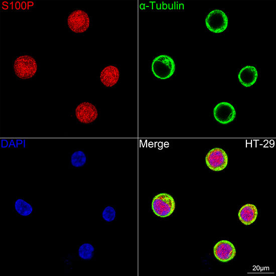 S100P Rabbit mAb