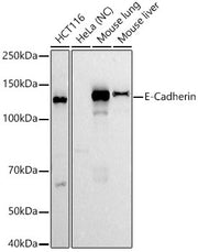 E-Cadherin Rabbit mAb