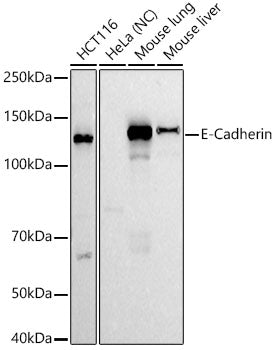 E-Cadherin Rabbit mAb
