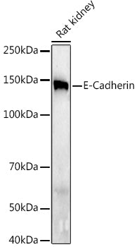 E-Cadherin Rabbit mAb