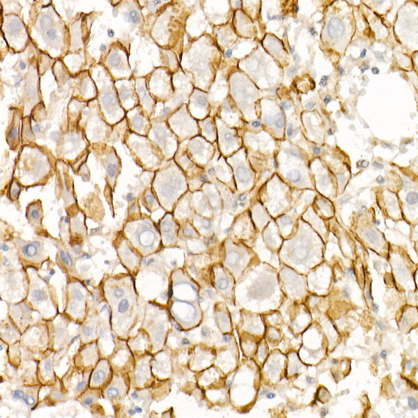 E-Cadherin Rabbit mAb