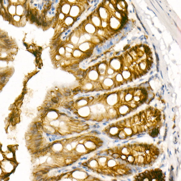 E-Cadherin Rabbit mAb